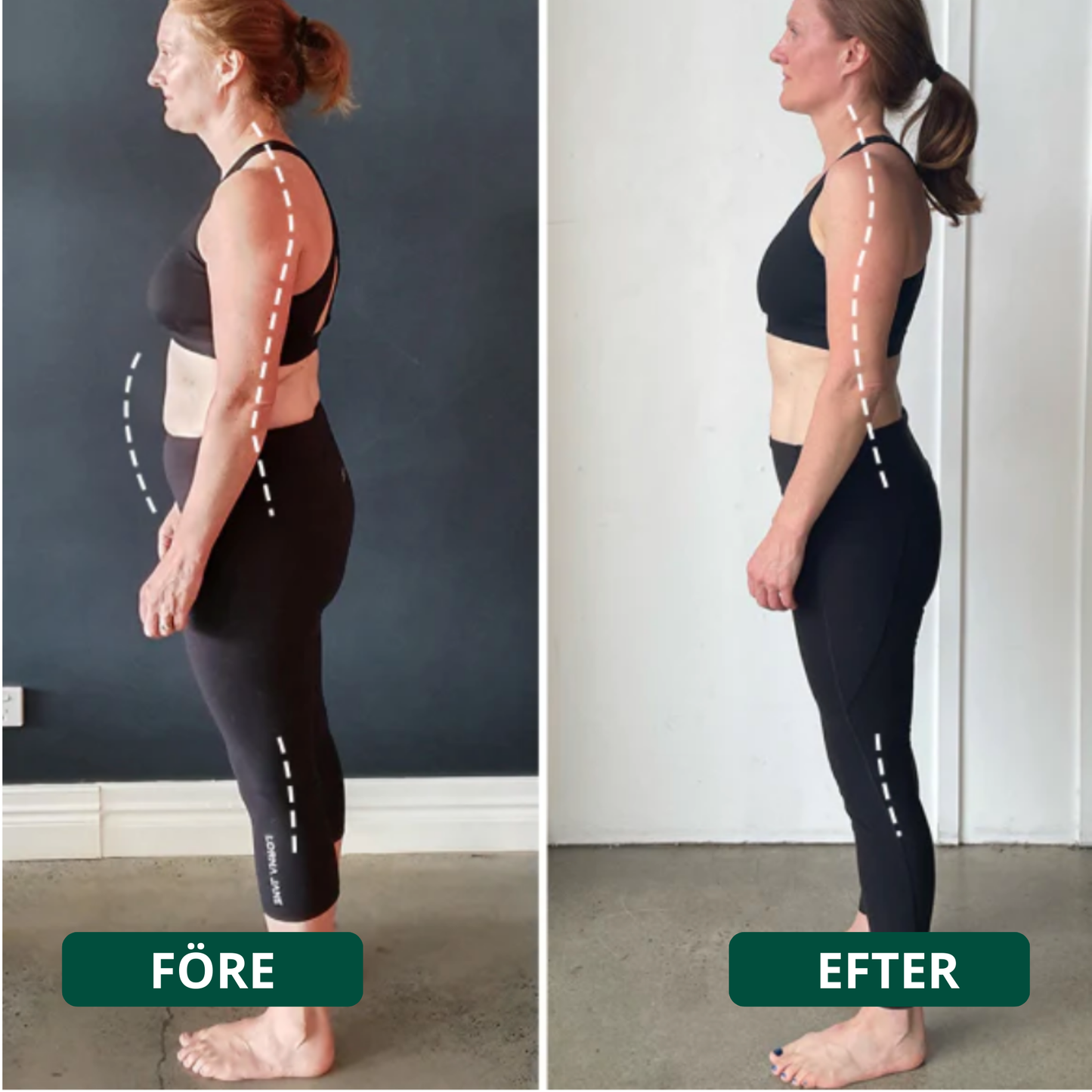 Ryggform™ – Lindrer rygsmerter og forbedrer kropsholdningen