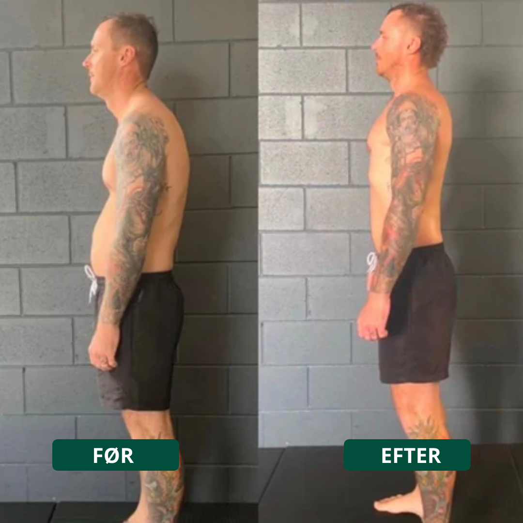 Ryggform™ – Lindrar ryggont och förbättrar hållningen