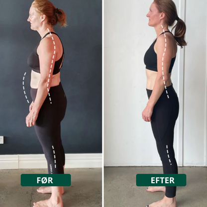 Ryggform™ – Lindrar ryggont och förbättrar hållningen